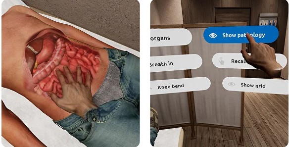 Mô hình thăm khám sờ nắn vùng bụng