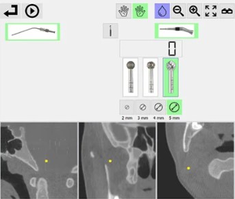 HỆ THỐNG PHẪU THUẬT TAI MŨI ẢO HỖ TRỢ HAPTICS
