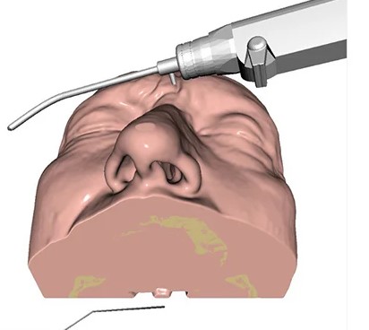 HỆ THỐNG PHẪU THUẬT TAI MŨI ẢO HỖ TRỢ HAPTICS