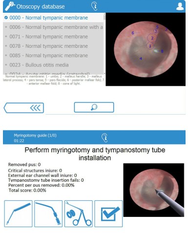 HỆ THỐNG SOI TAI ẢO